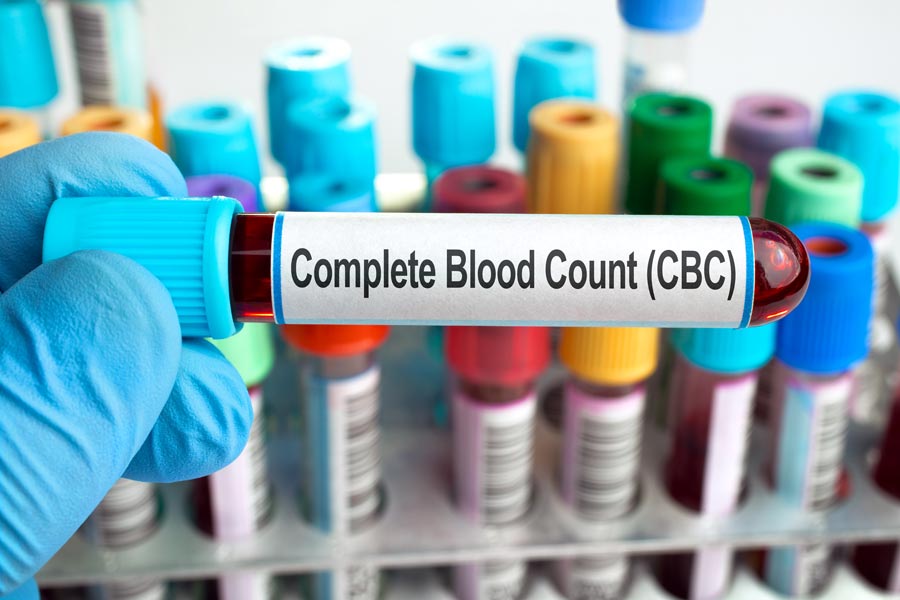 Complete Blood Count