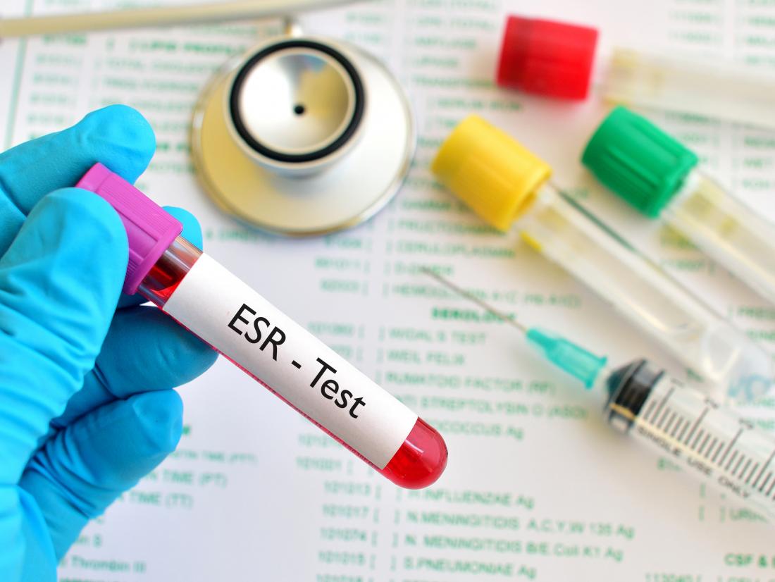 Erythrocyte sedimentation rate