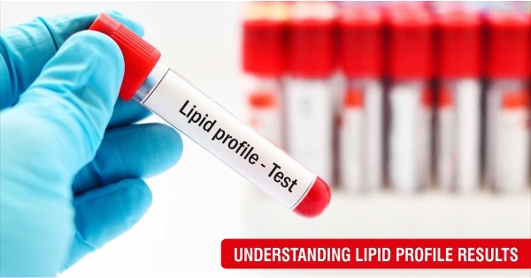 Lipid Profile