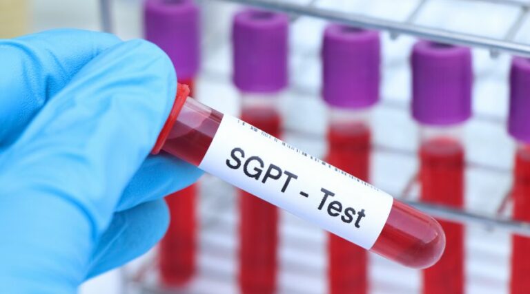 Serum Glutamic Pyruvic Transaminase (SGPT)