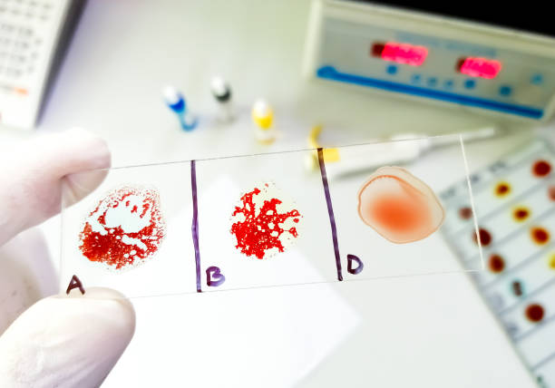 Blood Grouping